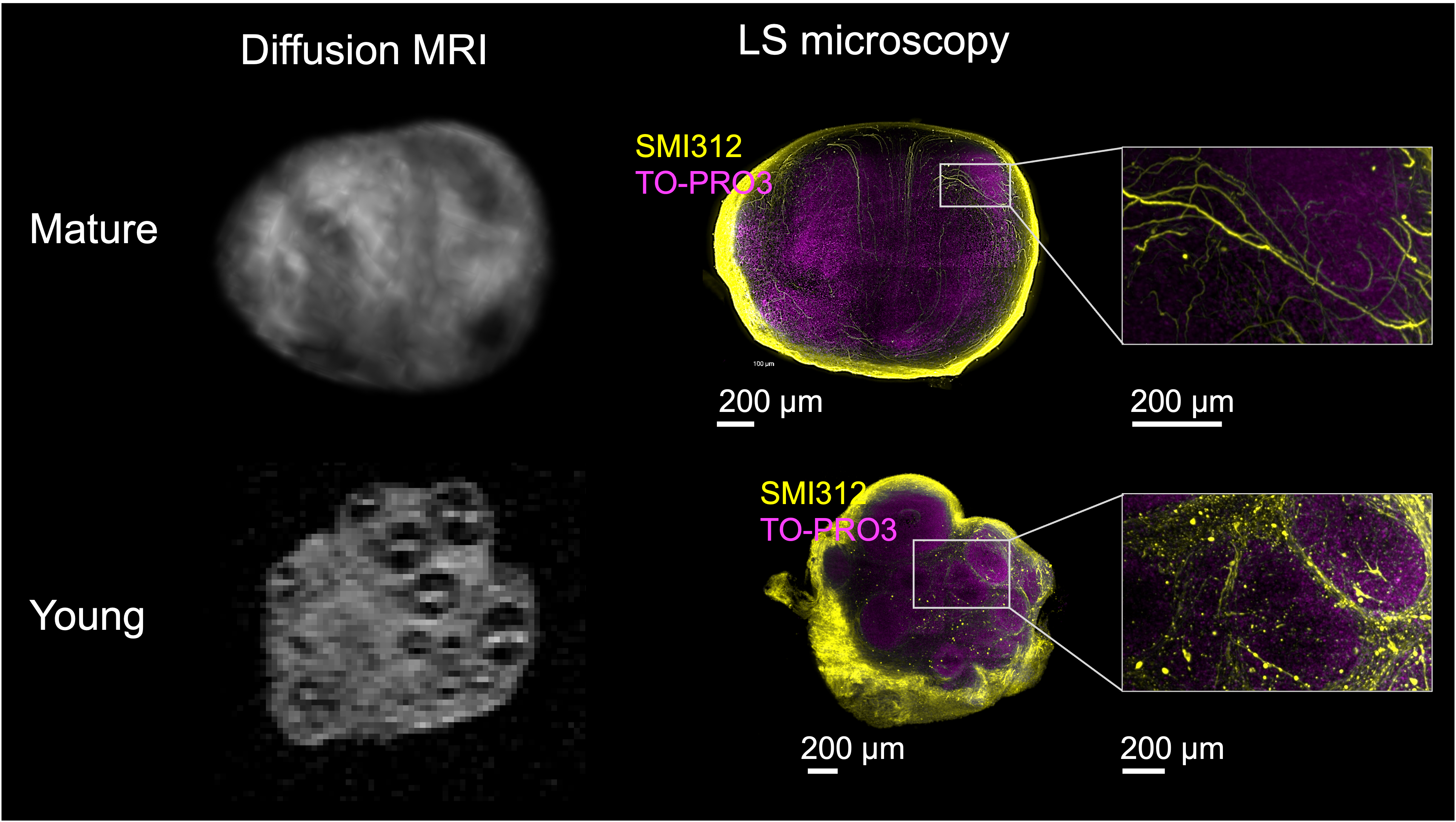 Microstructure imaging